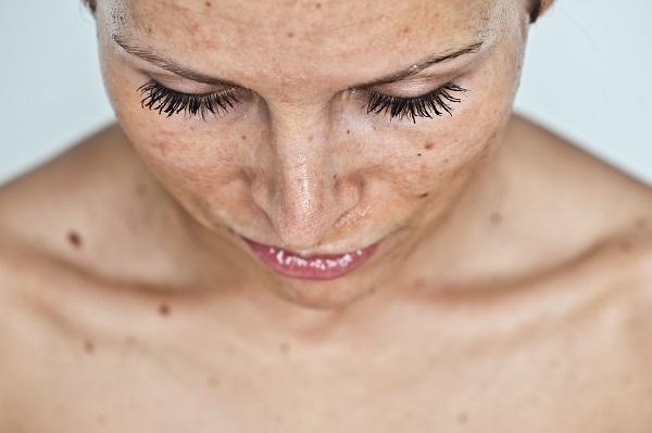 Zaštita od sunca – Zaštiti kožu uz pomoć maglice za lice